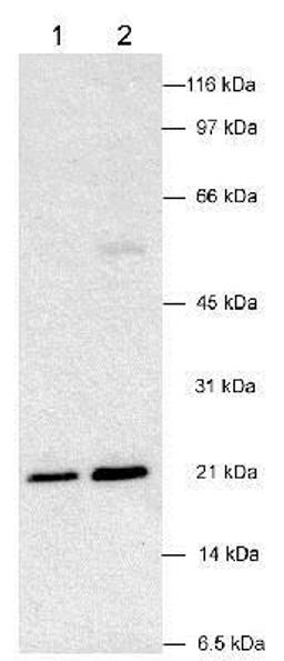 Western Blot: Von Hippel Lindau Antibody [NB100-485] - Detection of VHL in human kidney samples (30 ug)using NB 100-485. ECL detection 10 seconds. Lane 1: 0.5 ug/ml primary Lane 2: 2 ug/ml primary