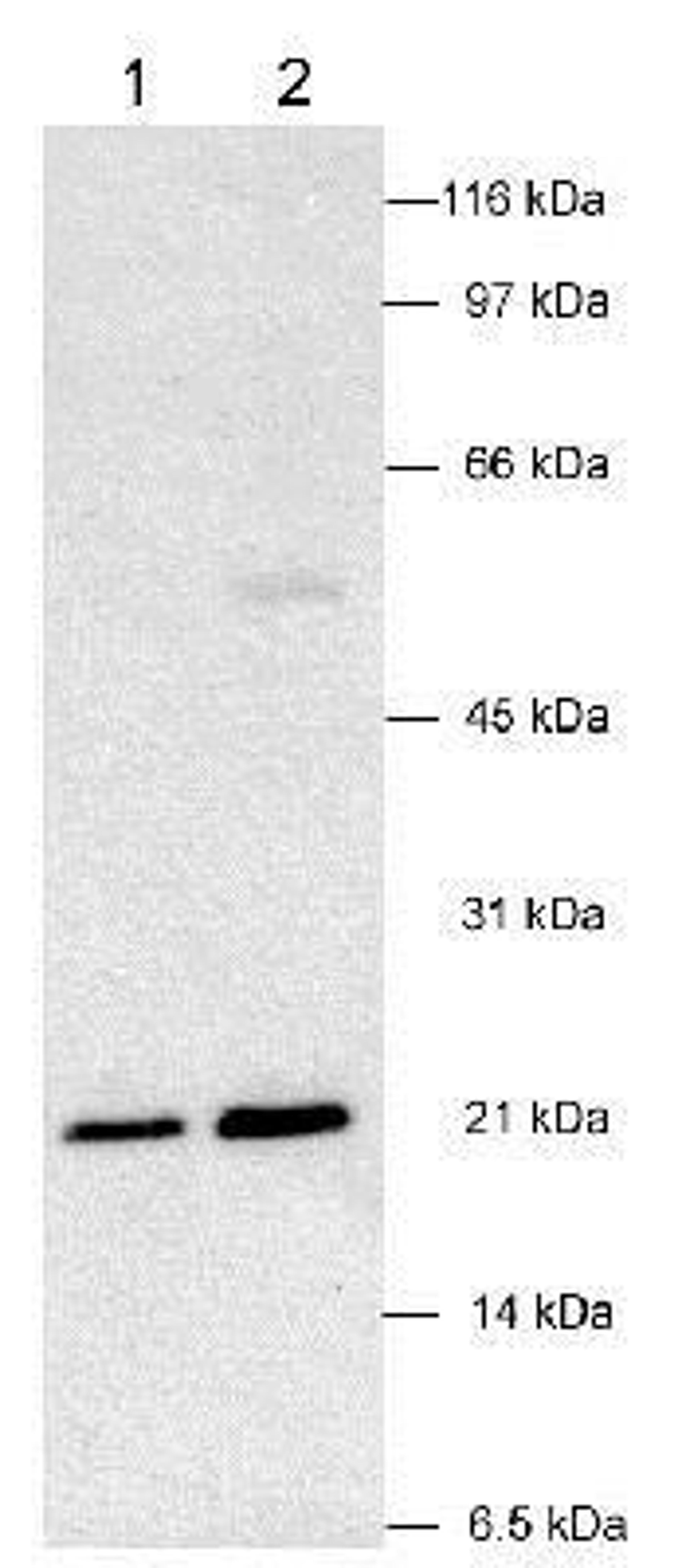 Western Blot: Von Hippel Lindau Antibody [NB100-485] - Detection of VHL in human kidney samples (30 ug)using NB 100-485. ECL detection 10 seconds. Lane 1: 0.5 ug/ml primary Lane 2: 2 ug/ml primary