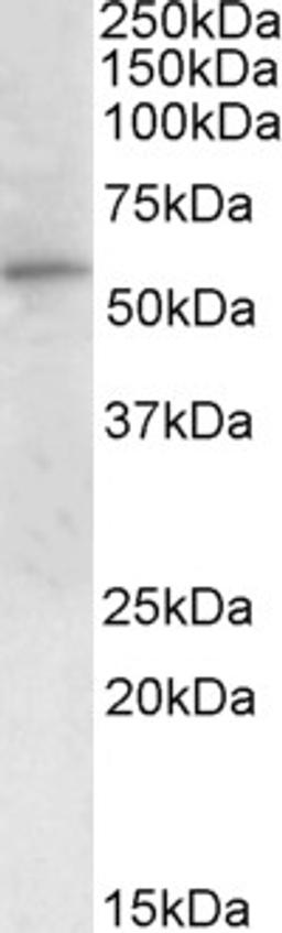 45-643 (1ug/ml) staining of Peripheral Blood Mononucleocytes lysate (35ug protein in RIPA buffer). Primary incubation was 1 hour. Detected by chemiluminescence.