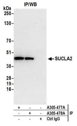 Detection of human SUCLA2 by western blot of immunoprecipitates.