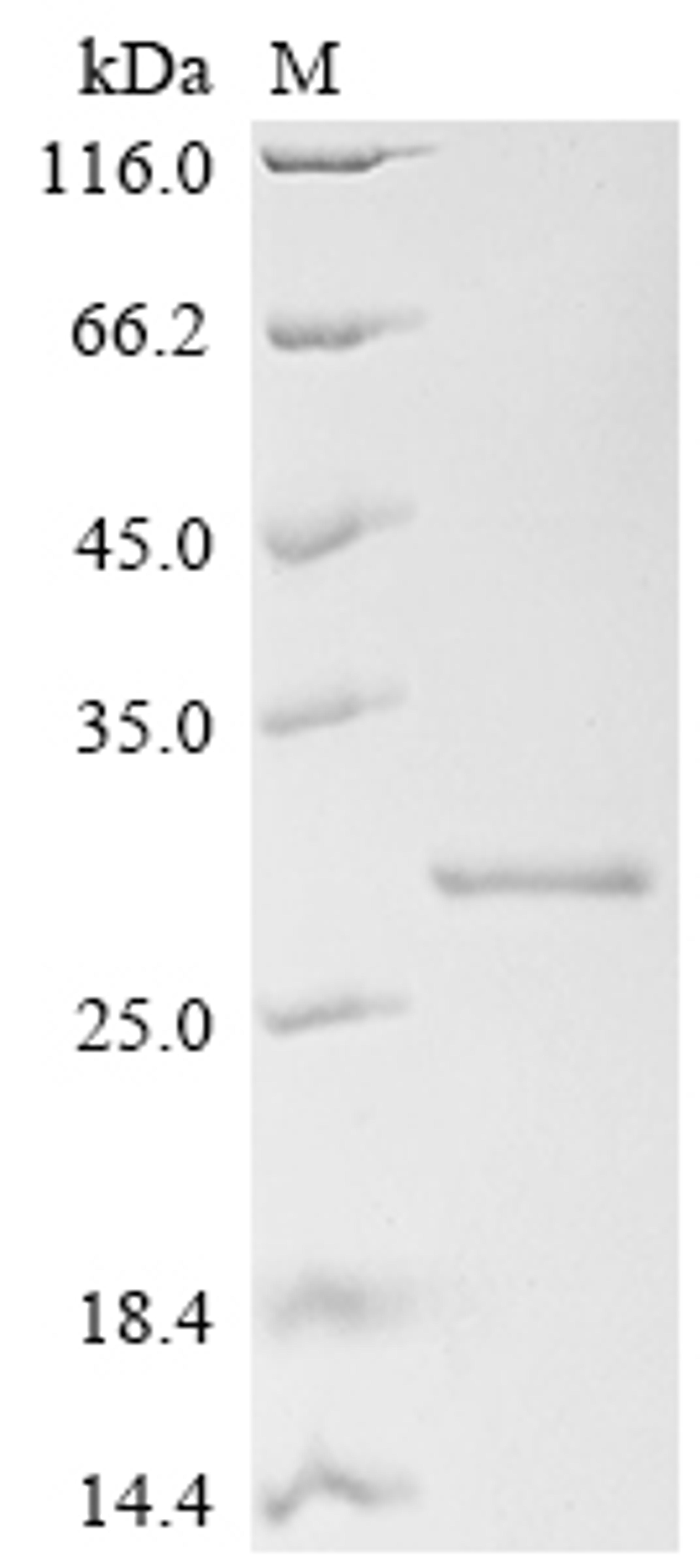 (Tris-Glycine gel) Discontinuous SDS-PAGE (reduced) with 5% enrichment gel and 15% separation gel.