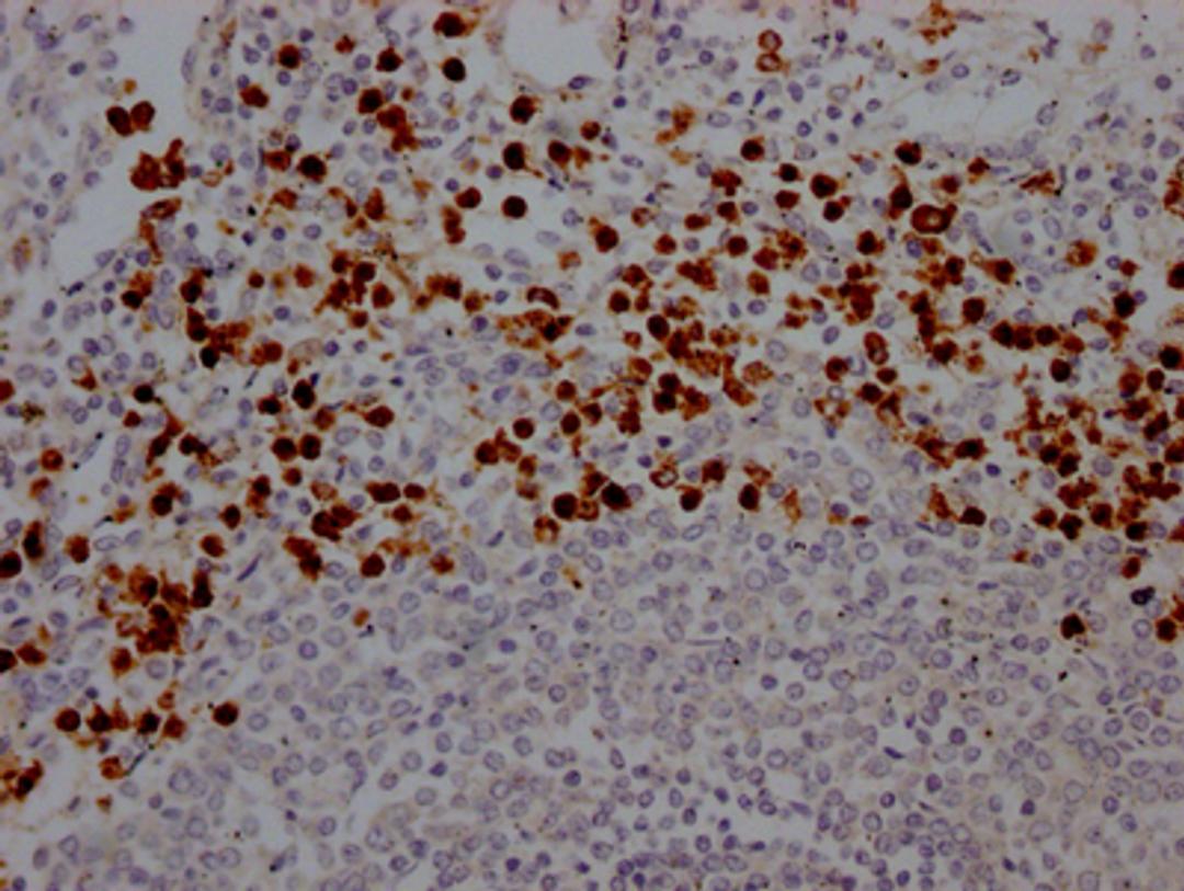 IHC image of CSB-RA617176A0HU diluted at 1:100 and staining in paraffin-embedded human spleen tissue performed on a Leica BondTM system. After dewaxing and hydration, antigen retrieval was mediated by high pressure in a citrate buffer (pH 6.0). Section was blocked with 10% normal goat serum 30min at RT. Then primary antibody (1% BSA) was incubated at 4℃ overnight. The primary is detected by a Goat anti-rabbit IgG polymer labeled by HRP and visualized using 0.05% DAB.
