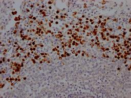 IHC image of CSB-RA617176A0HU diluted at 1:100 and staining in paraffin-embedded human spleen tissue performed on a Leica BondTM system. After dewaxing and hydration, antigen retrieval was mediated by high pressure in a citrate buffer (pH 6.0). Section was blocked with 10% normal goat serum 30min at RT. Then primary antibody (1% BSA) was incubated at 4℃ overnight. The primary is detected by a Goat anti-rabbit IgG polymer labeled by HRP and visualized using 0.05% DAB.