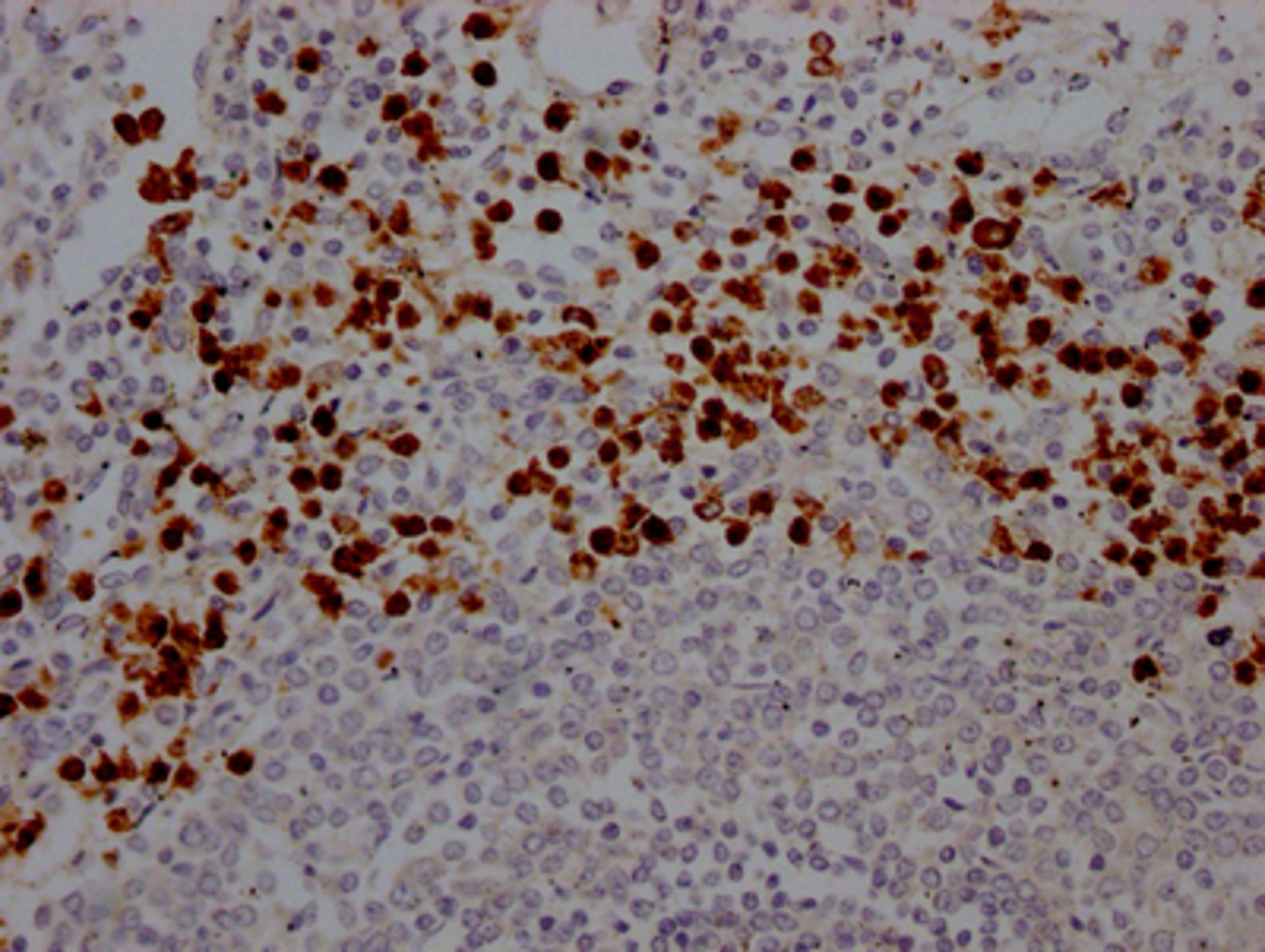 IHC image of CSB-RA617176A0HU diluted at 1:100 and staining in paraffin-embedded human spleen tissue performed on a Leica BondTM system. After dewaxing and hydration, antigen retrieval was mediated by high pressure in a citrate buffer (pH 6.0). Section was blocked with 10% normal goat serum 30min at RT. Then primary antibody (1% BSA) was incubated at 4℃ overnight. The primary is detected by a Goat anti-rabbit IgG polymer labeled by HRP and visualized using 0.05% DAB.