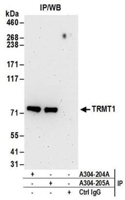 Detection of human TRMT1 by western blot of immunoprecipitates.