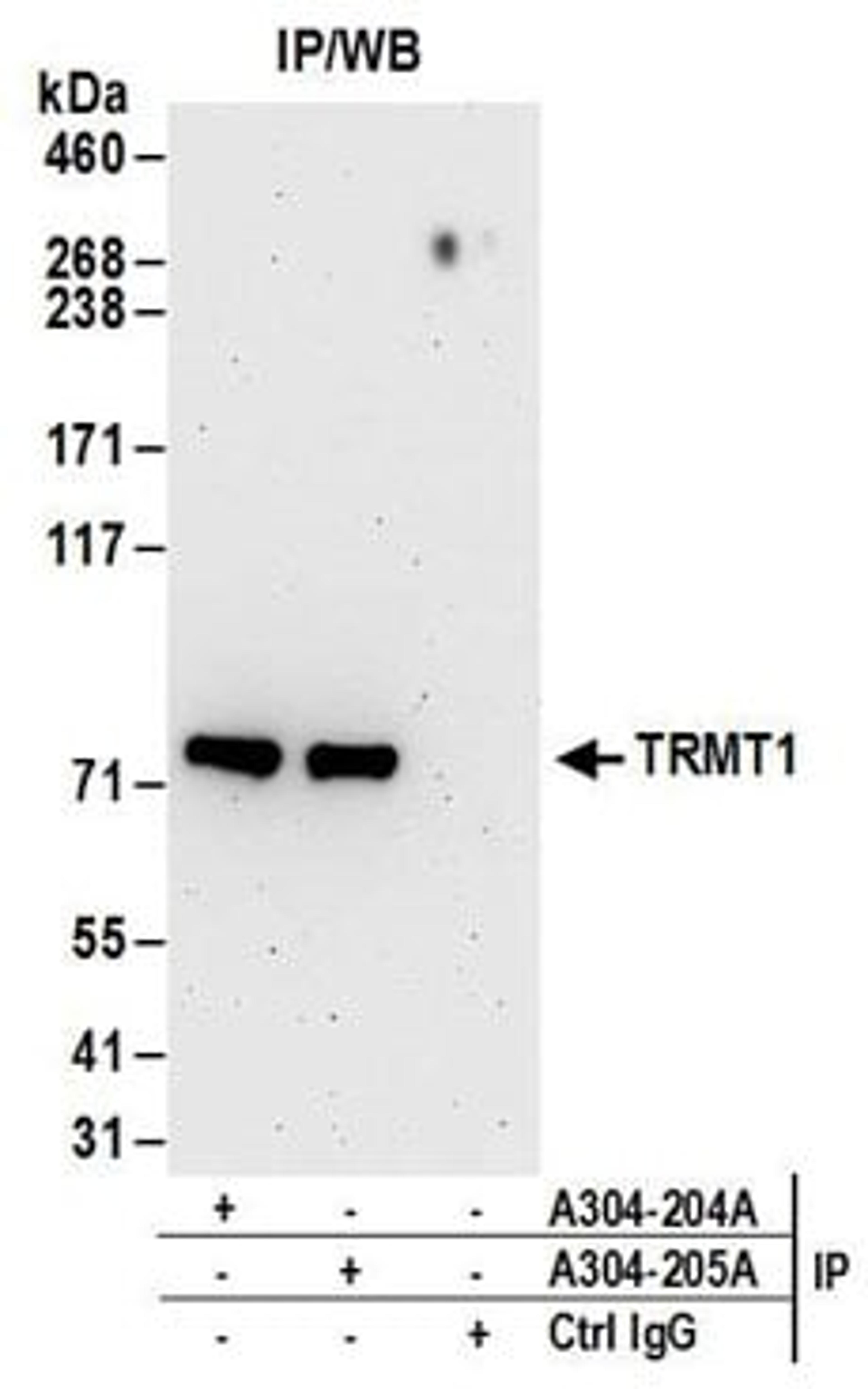 Detection of human TRMT1 by western blot of immunoprecipitates.