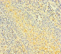 Immunohistochemistry of paraffin-embedded human tonsil tissue using CSB-PA819483LA01HU at dilution of 1:100