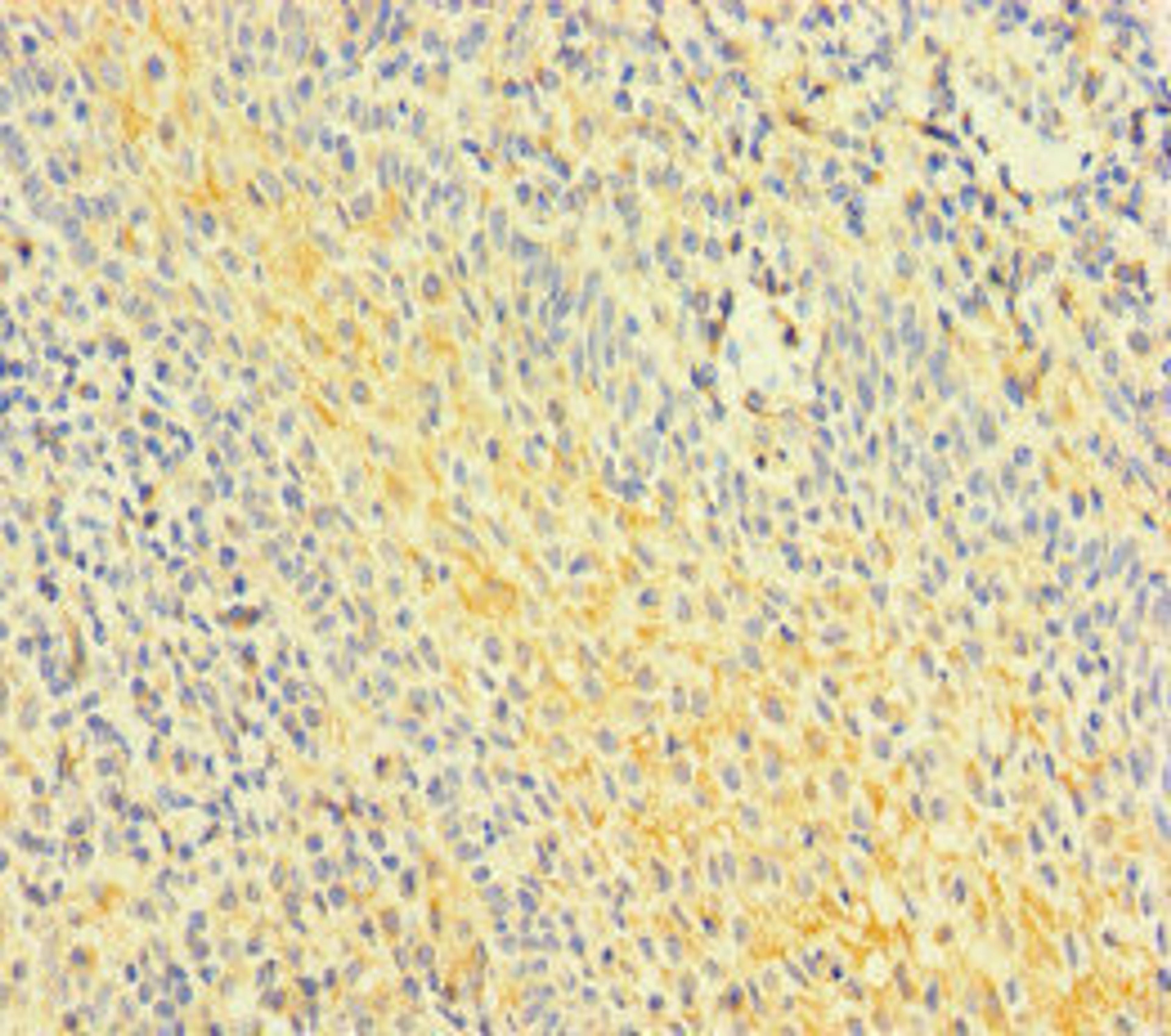 Immunohistochemistry of paraffin-embedded human tonsil tissue using CSB-PA819483LA01HU at dilution of 1:100