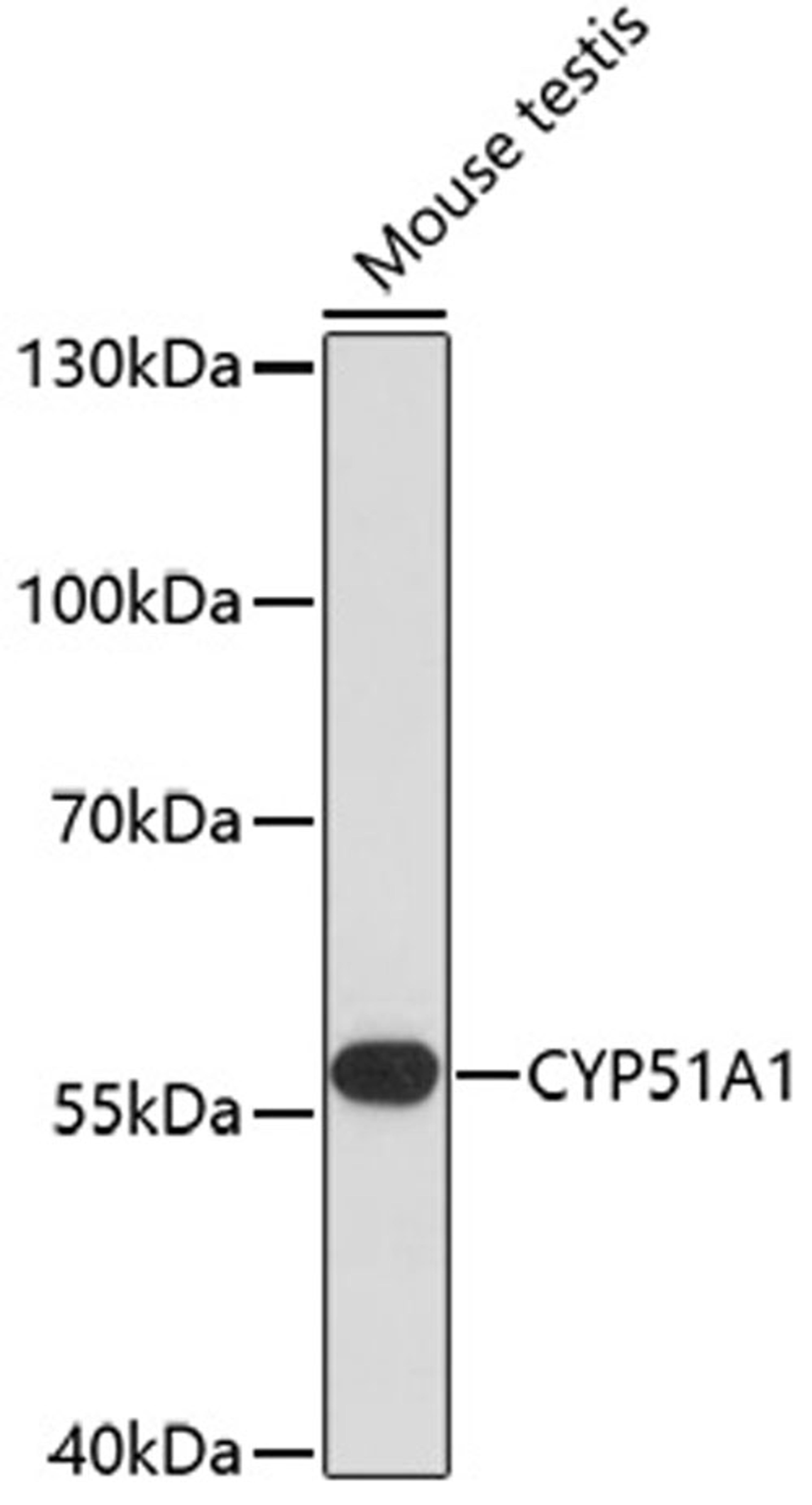 Western blot - CYP51A1 antibody (A13485)