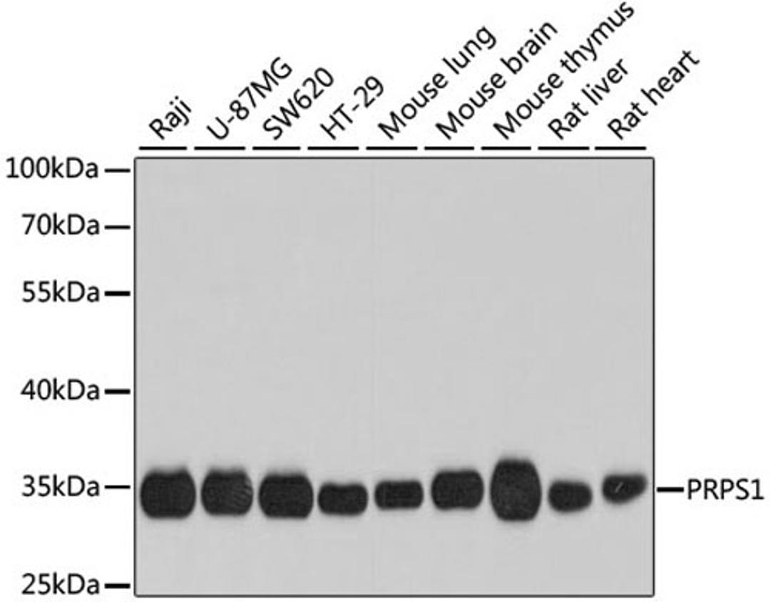 Western blot - PRPS1 antibody (A8145)