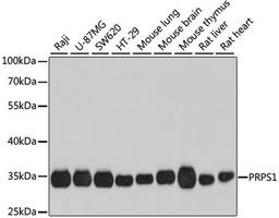 Western blot - PRPS1 antibody (A8145)