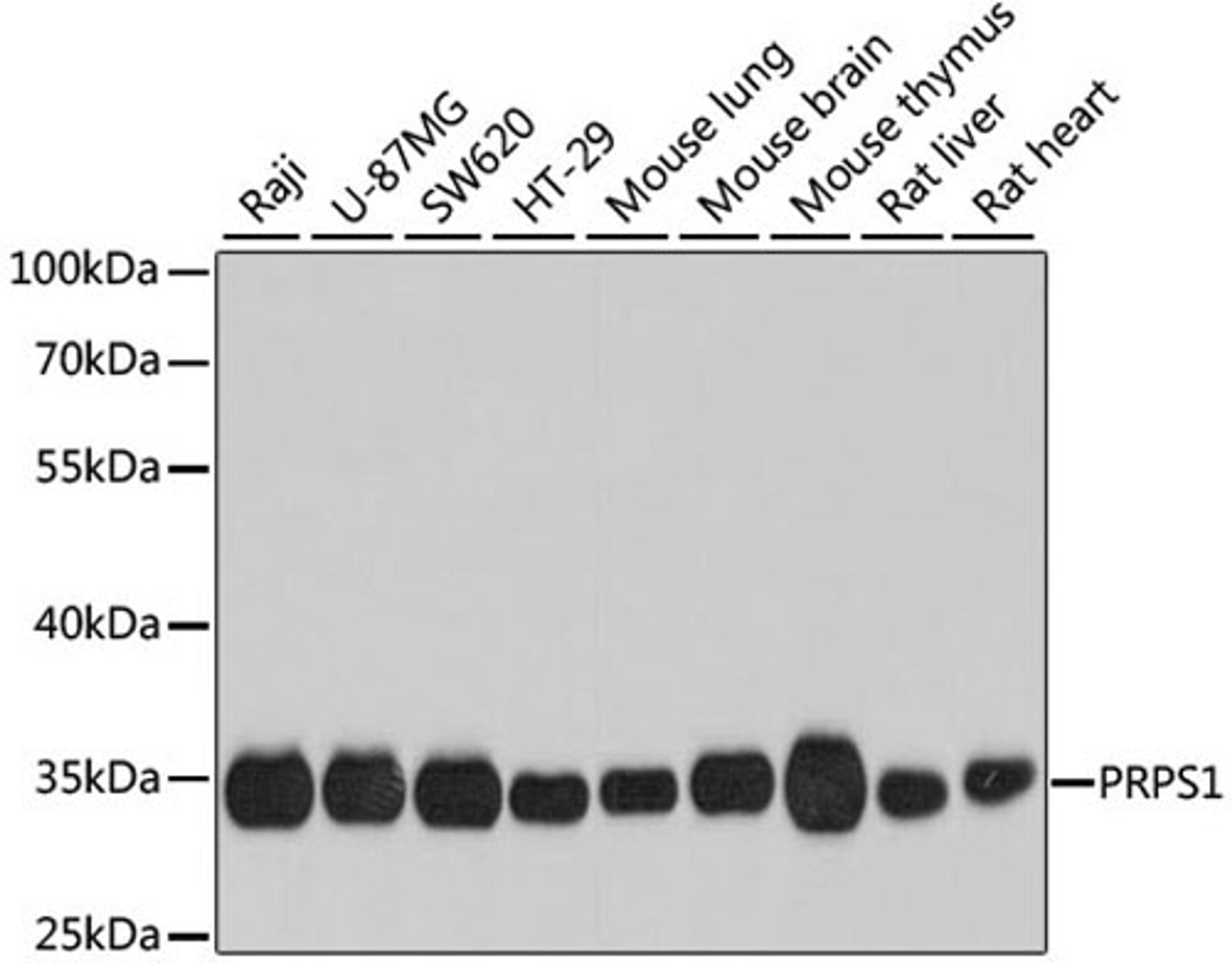 Western blot - PRPS1 antibody (A8145)