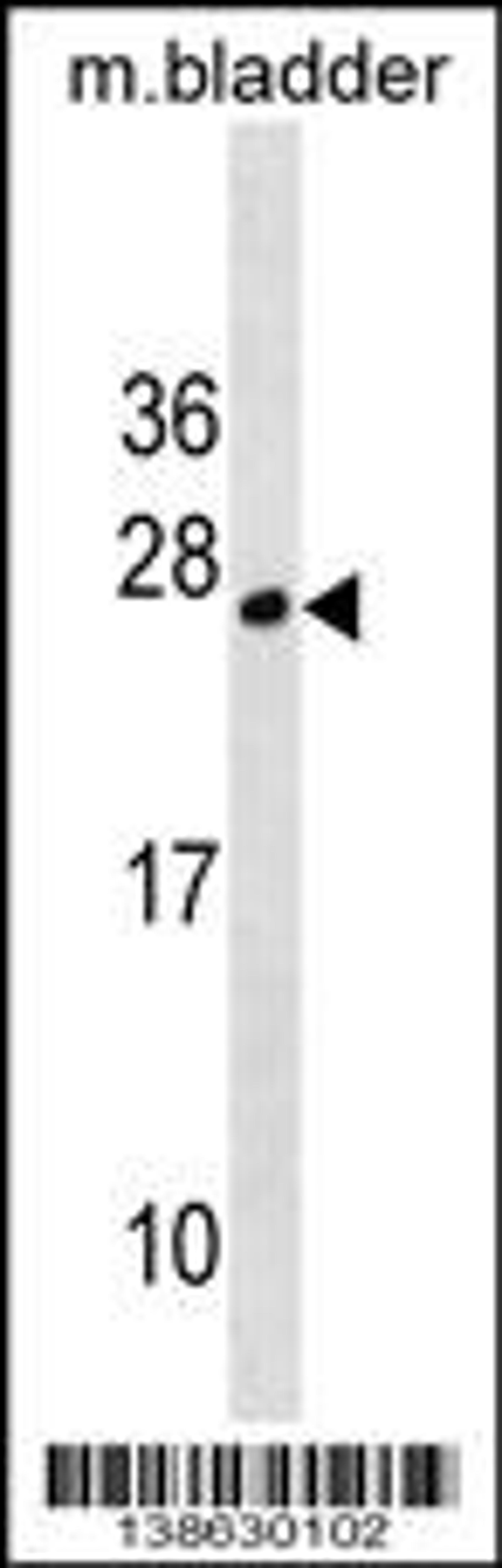 Western blot analysis in mouse bladder tissue lysates (35ug/lane).