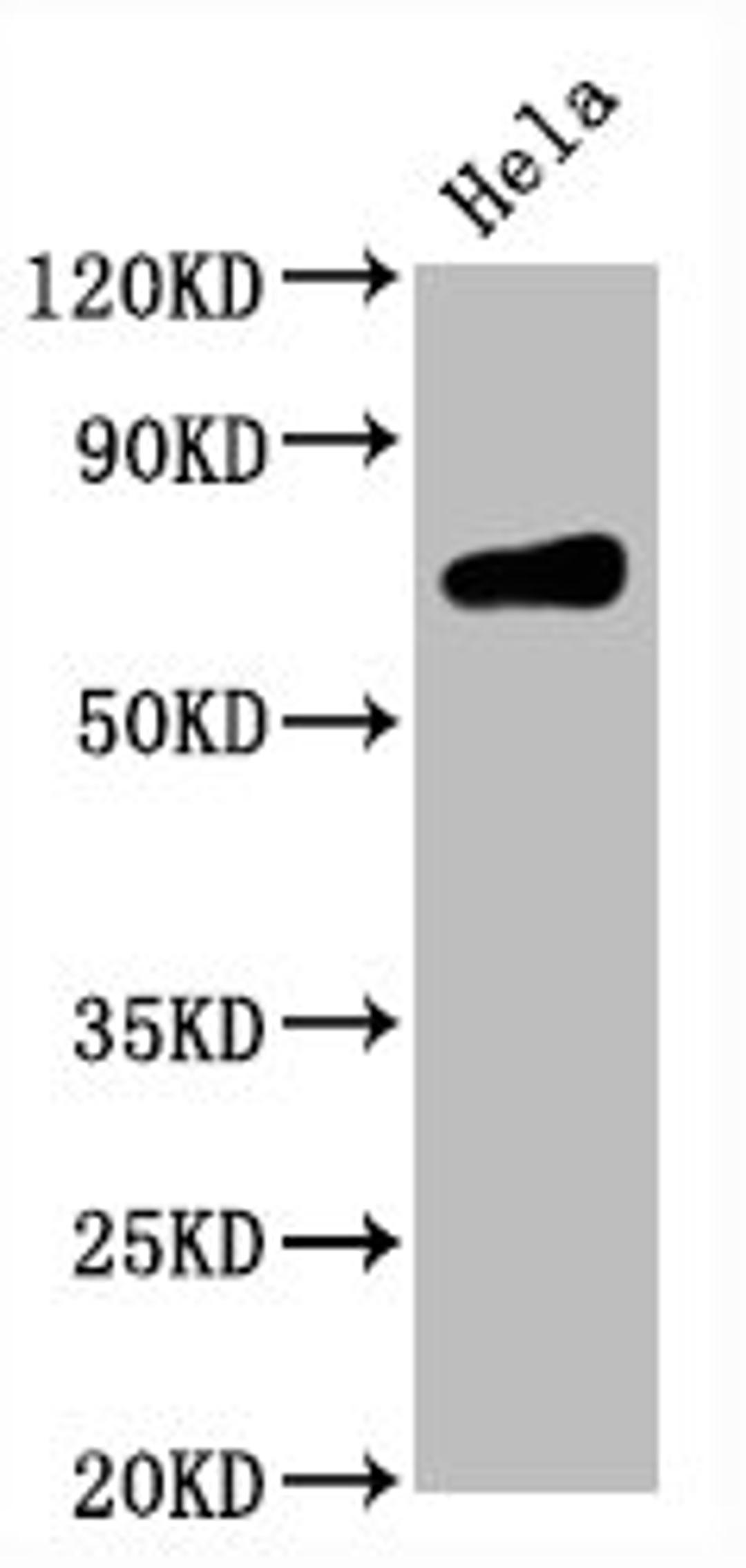 Western Blot. Positive WB detected in Hela whole cell lysate. All lanes CD86 antibody at 0.55μg/ml. Secondary. Goat polyclonal to rabbit IgG at 1/50000 dilution. Predicted band size: 70 KDa. Observed band size: 70 KDa. 