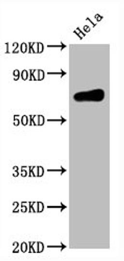 Western Blot. Positive WB detected in Hela whole cell lysate. All lanes CD86 antibody at 0.55μg/ml. Secondary. Goat polyclonal to rabbit IgG at 1/50000 dilution. Predicted band size: 70 KDa. Observed band size: 70 KDa. 