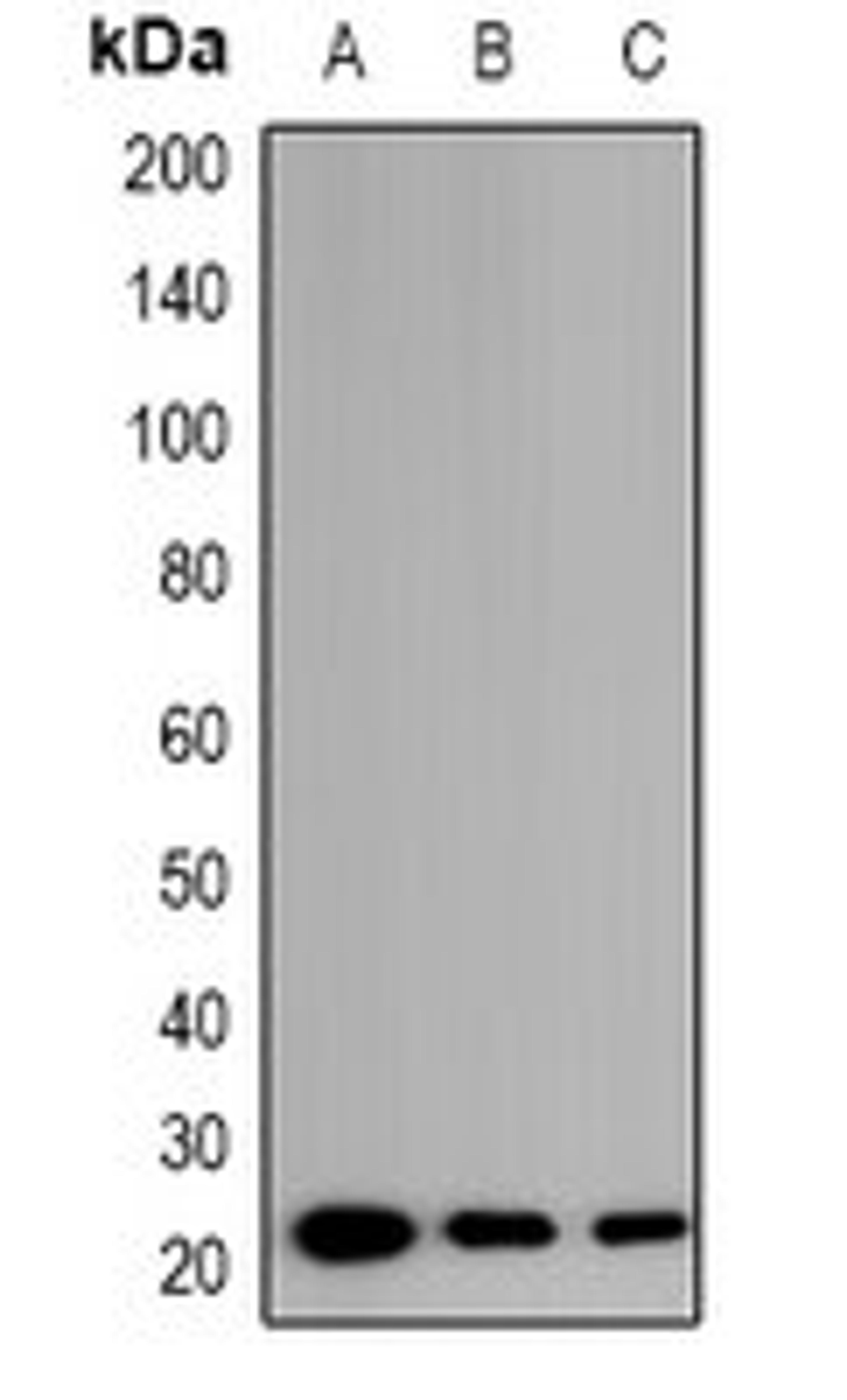 Western blot analysis of PC3 (Lane1), HeLa (Lane2), HCT116 (Lane3) whole cell lysates using EID1 antibody