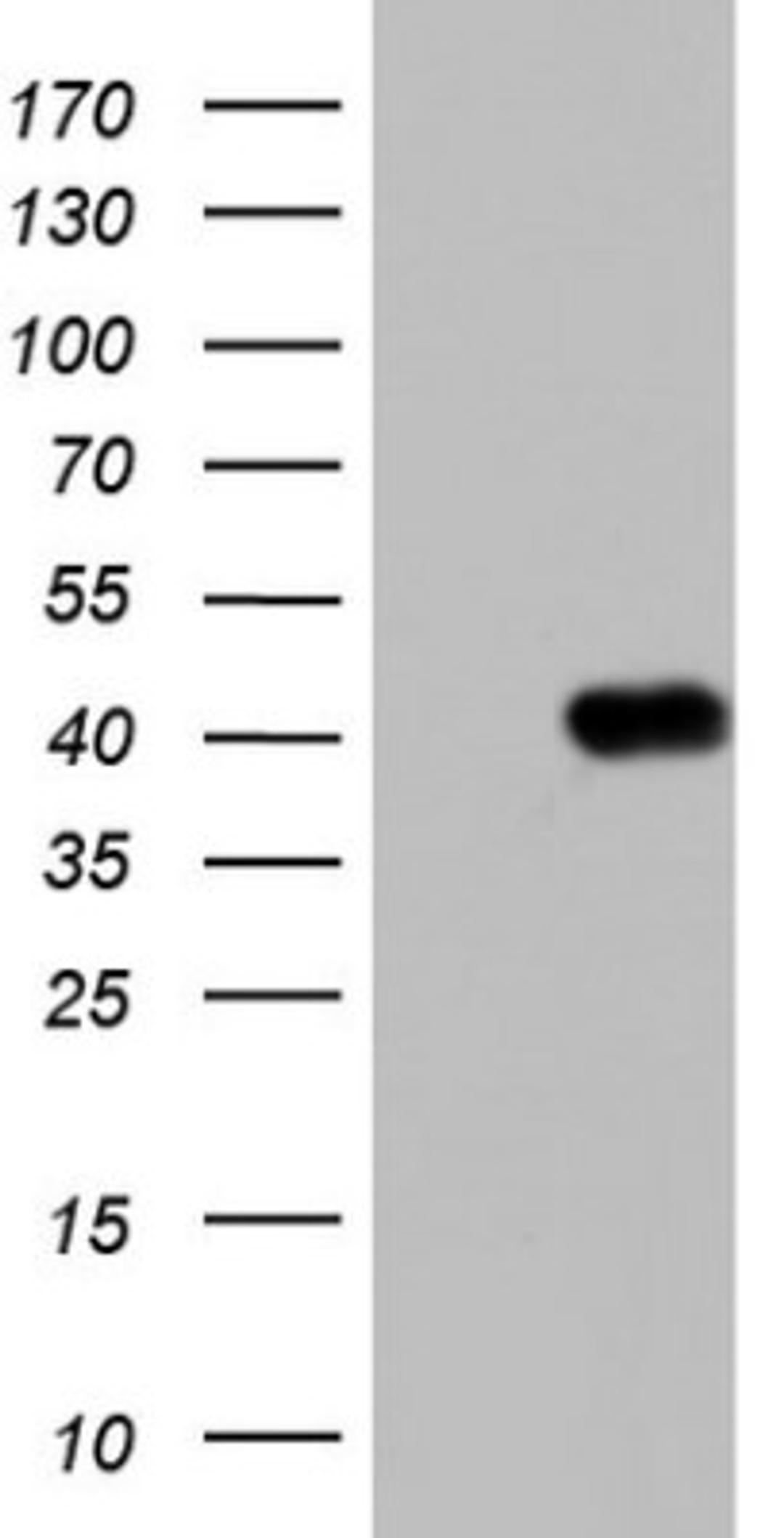 Western Blot: Boll Antibody (2D11) [NBP2-46582] - Analysis of HEK293T cells were transfected with the pCMV6-ENTRY control (Left lane) or pCMV6-ENTRY BOLL.