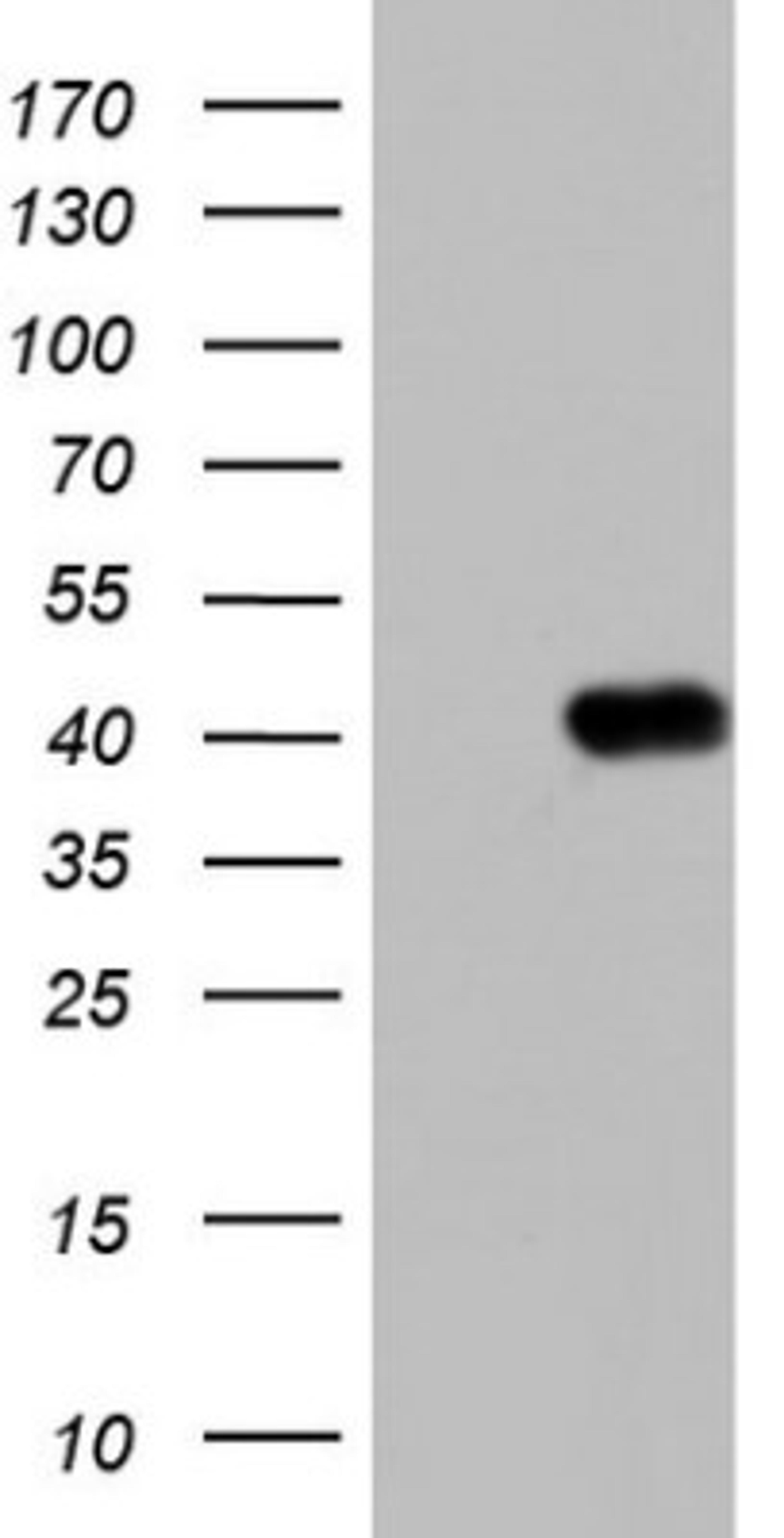 Western Blot: Boll Antibody (2D11) [NBP2-46582] - Analysis of HEK293T cells were transfected with the pCMV6-ENTRY control (Left lane) or pCMV6-ENTRY BOLL.