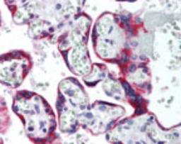 Immunohistochemistry-Paraffin: Somatostatin Receptor 5 Antibody [NB100-56498] - analysis of human placenta using Somatostatin Receptor 5 antibody at 10 ug/ml.