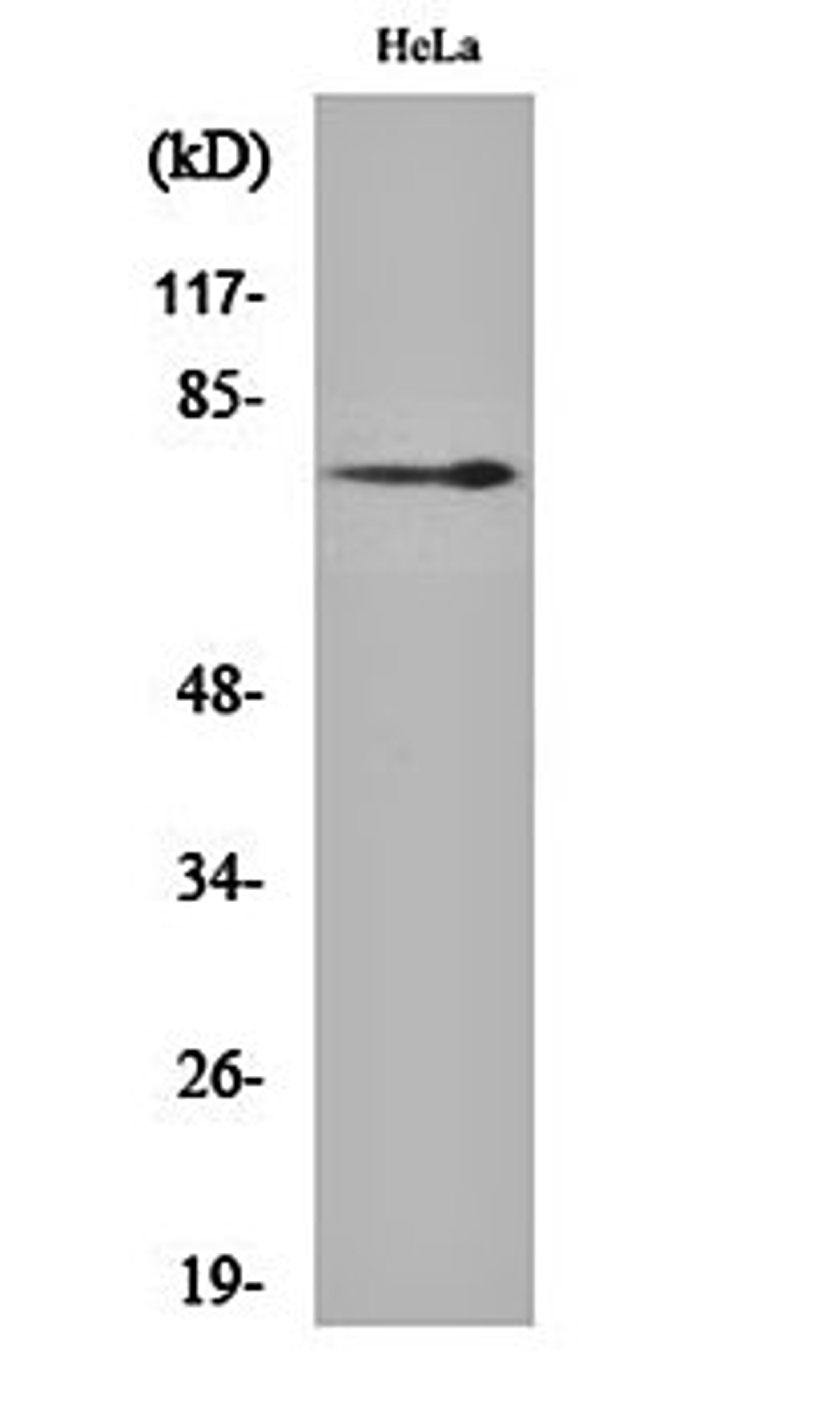 Western blot analysis of Hela cell lysates using NGFR p75 antibody