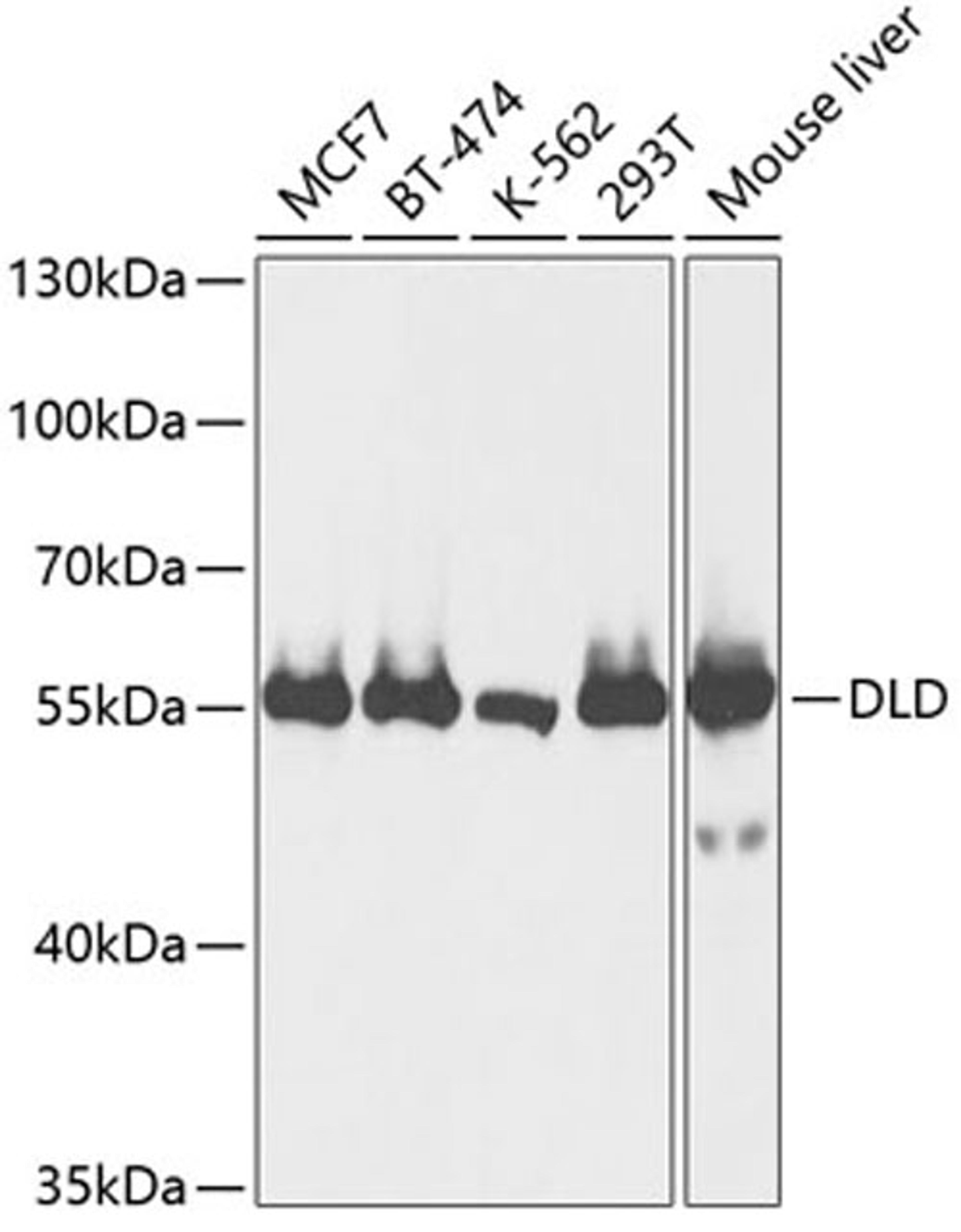 Western blot - DLD antibody (A13296)