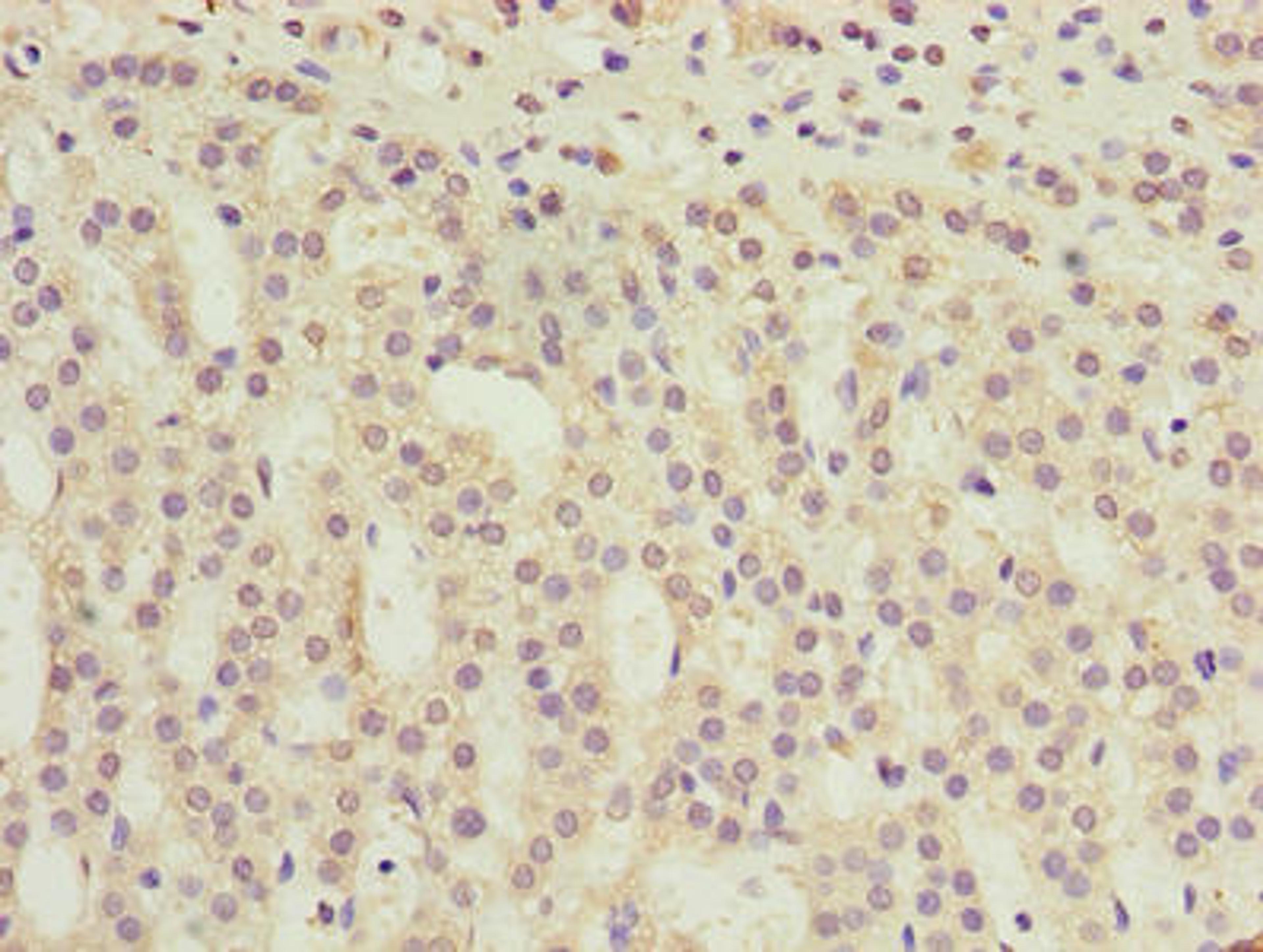 Immunohistochemistry of paraffin-embedded human adrenal gland tissue using CSB-PA023828LA01HU at dilution of 1:100