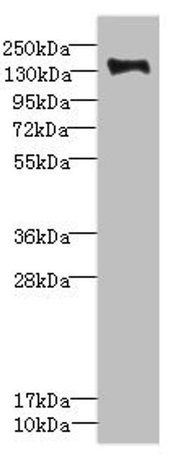 Western blot. All lanes: PLXNB2 antibody IgG at 2.39ug/ml + Mouse liver tissue. Secondary. Goat polyclonal to rabbit IgG at 1/10000 dilution. Predicted band size: 205 kDa. Observed band size: 205 kDa. 