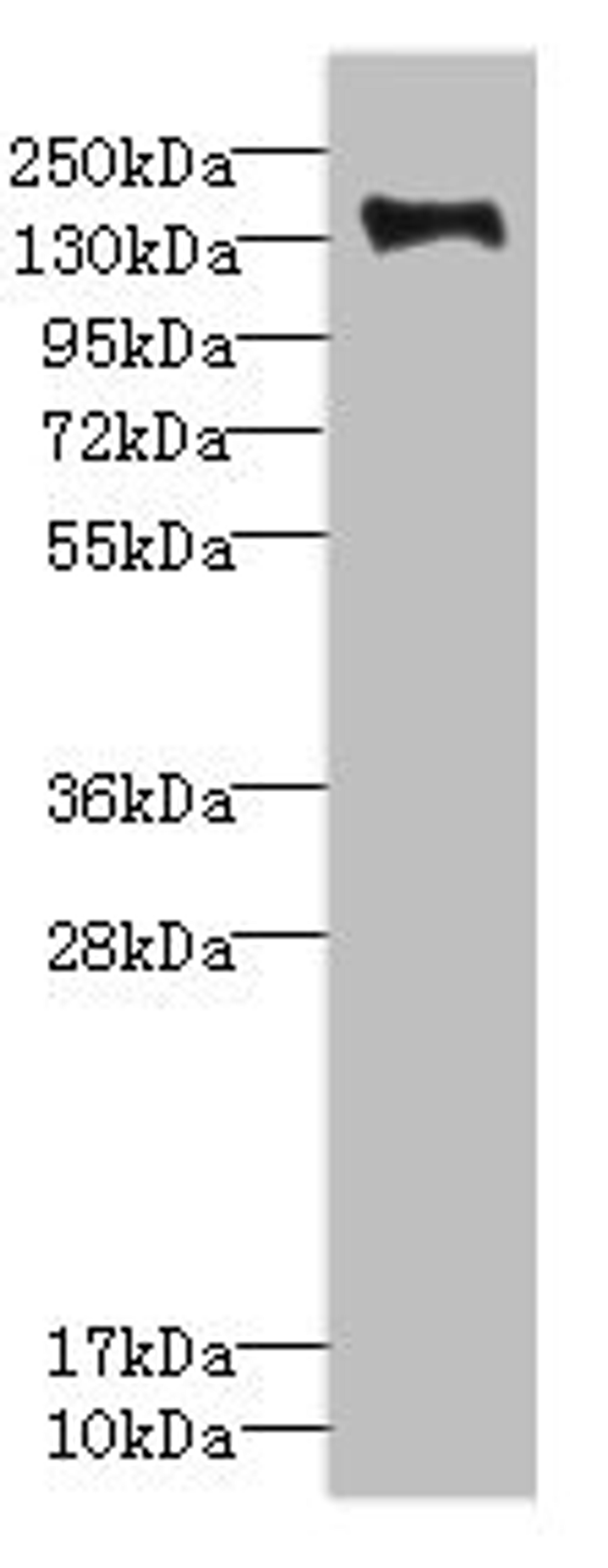 Western blot. All lanes: PLXNB2 antibody IgG at 2.39ug/ml + Mouse liver tissue. Secondary. Goat polyclonal to rabbit IgG at 1/10000 dilution. Predicted band size: 205 kDa. Observed band size: 205 kDa. 