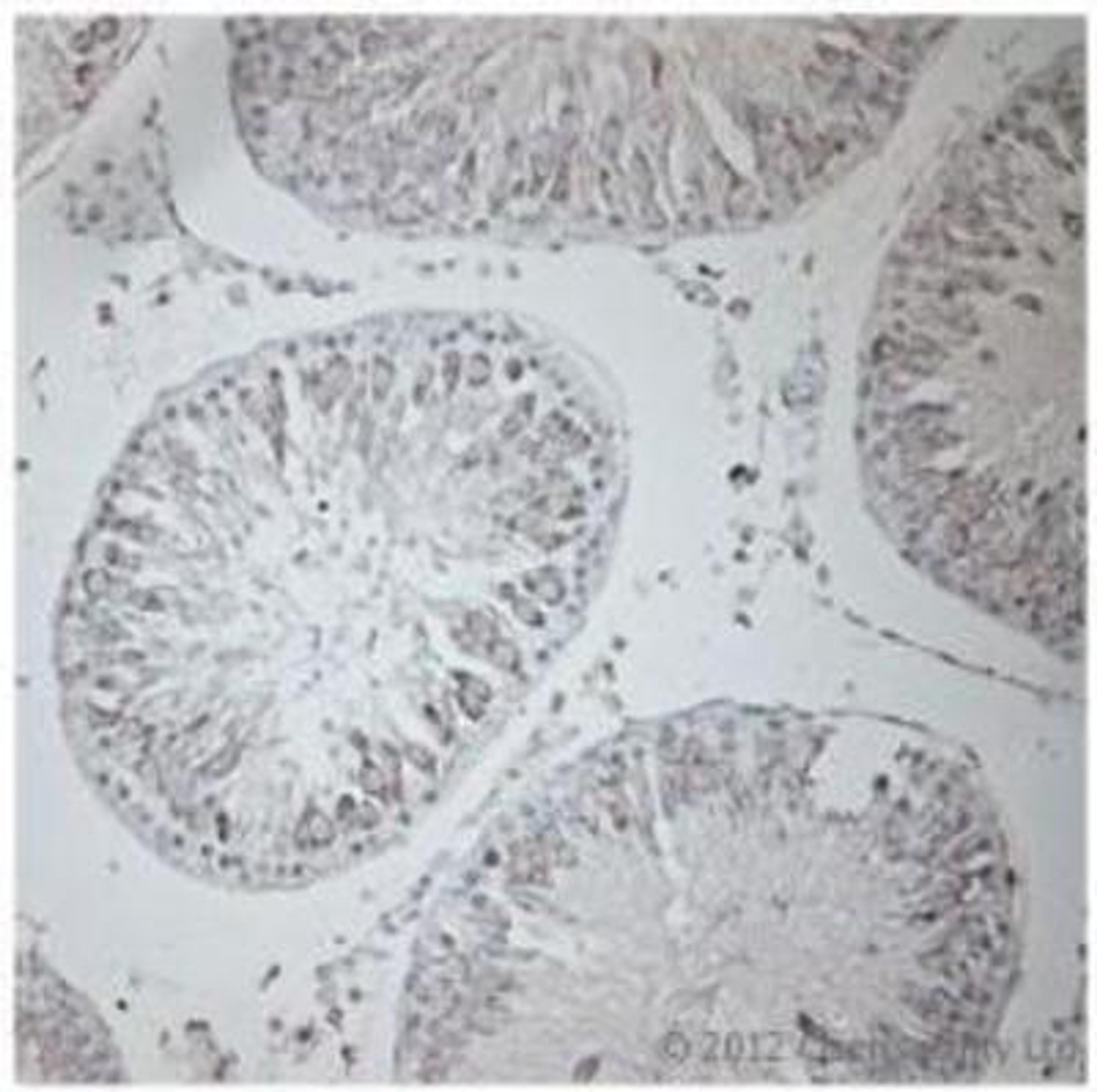 Immunohistochemistry-Paraffin: P2RX7 Antibody [NBP1-20180] - IHC on rat testis (paraffin section) using Rabbit antibody to extracellular domain of P2X7 (P2RX7, P2X purinoceptor 7, Purinergic receptor): whole serum (NBP1-20180) at 1: 200 dilution incubated overnight at 4C.