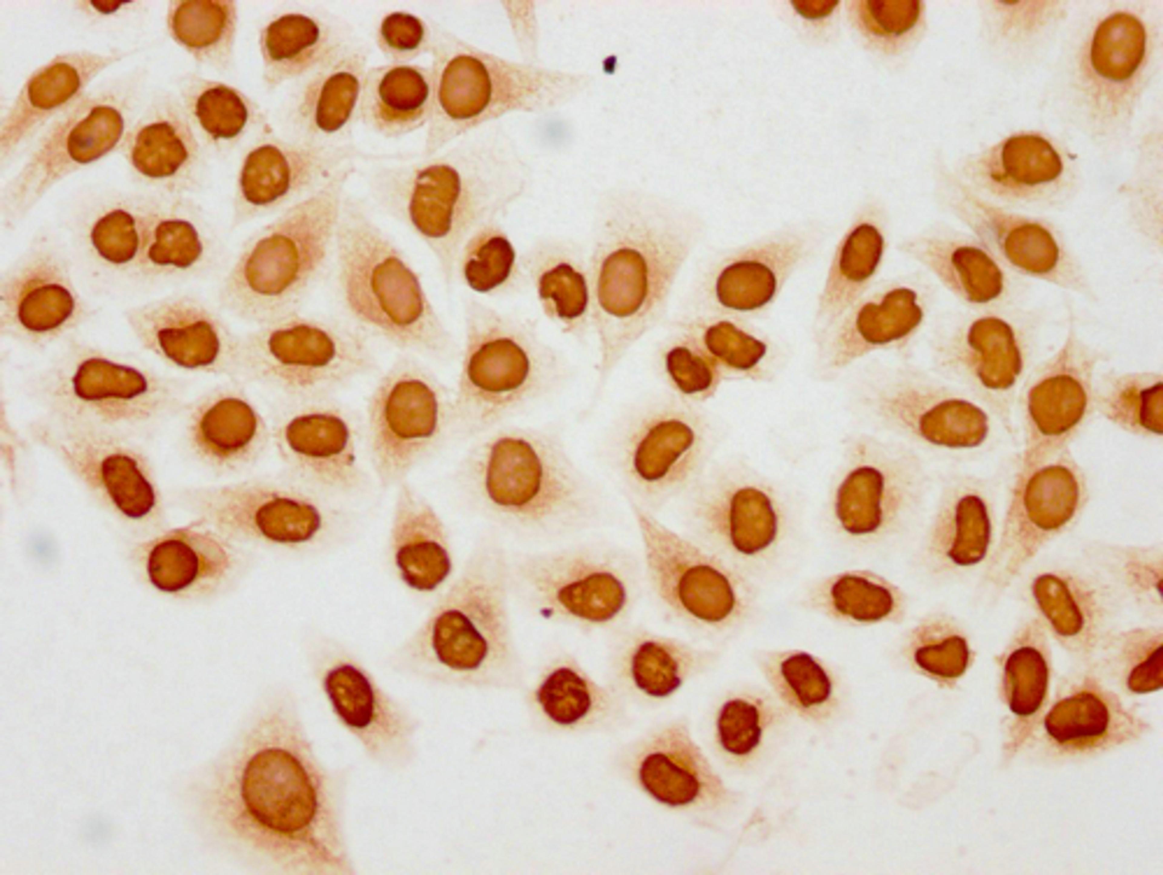 Immunocytochemistry analysis of CSB-PA010403PA20acHU diluted at 1:10 and staining in Hela cells(treated with 30mM sodium butyrate for 4h) performed on a Leica BondTM system. The cells were fixed in 4% formaldehyde, permeabilized using 0.2% Triton X-100 and blocked with 10% normal goat serum 30min at RT. Then primary antibody (1% BSA) was incubated at 4°C overnight. The primary is detected by a biotinylated secondary antibody and visualized using an HRP conjugated SP system.