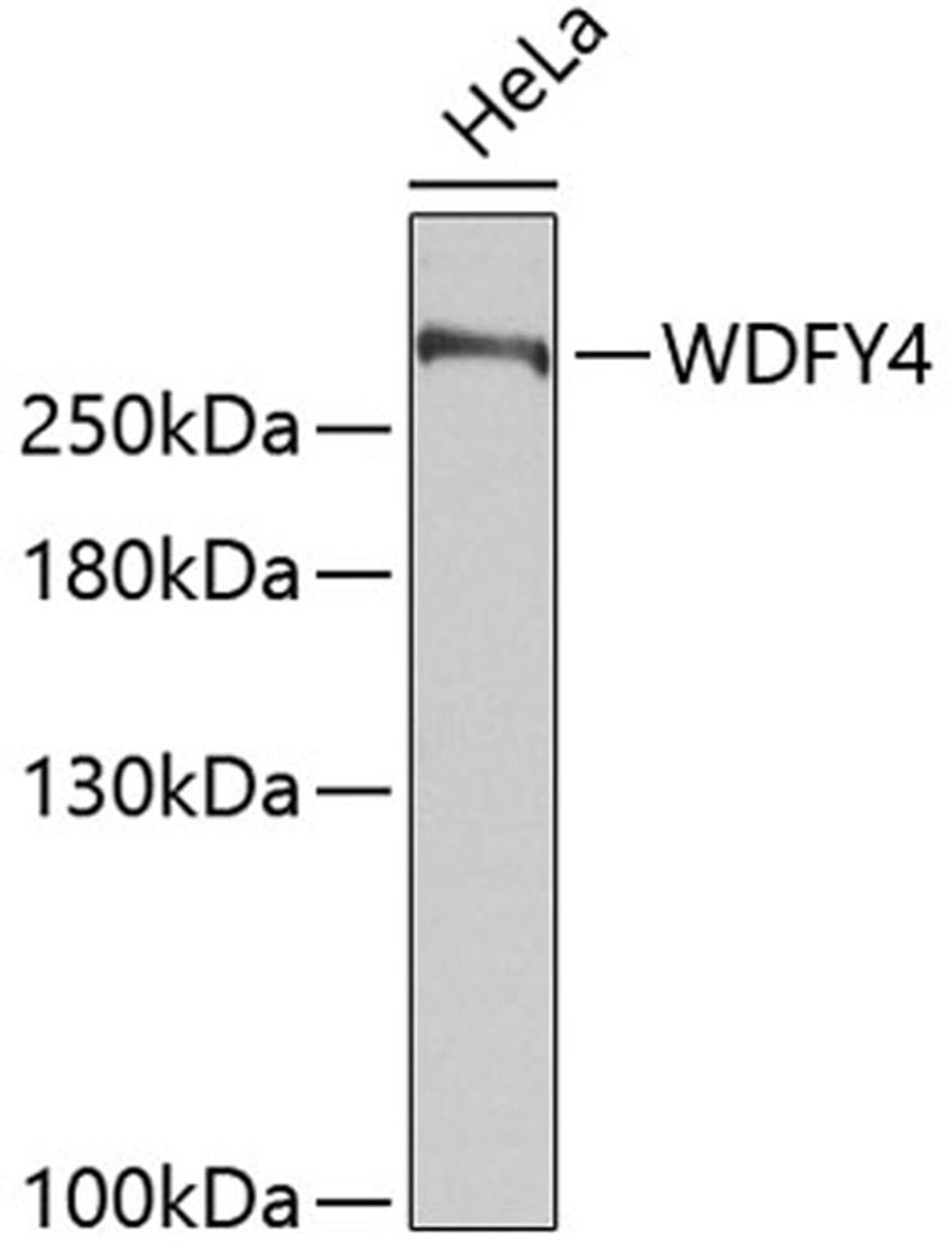 Western blot - WDFY4 antibody (A4897)