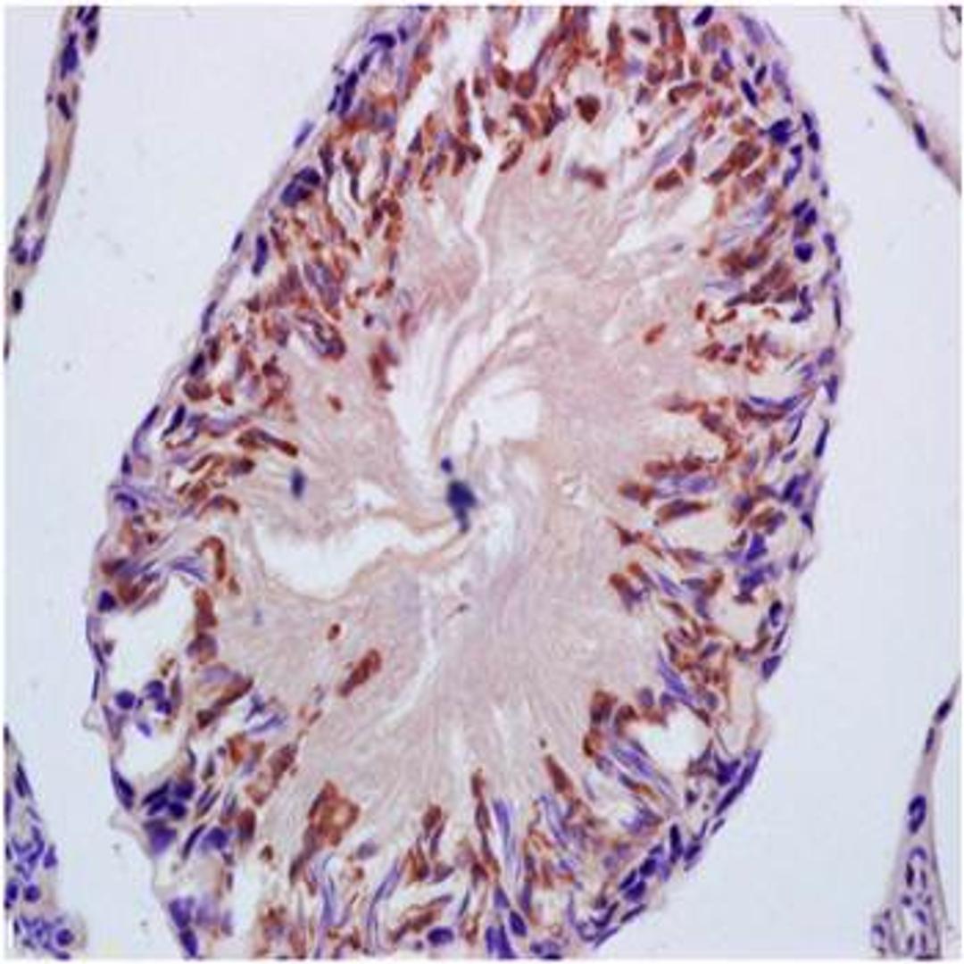 Paraffin-embedded rat testis tissue fixed with 4% paraformaldehyde. Antigen retrieval by boiling with citrate buffer. Blocking buffer is goat serum (37 degrees for 20 min.). CYP21 antibody at 1:200 dilution with overnight incubation at 4 degrees