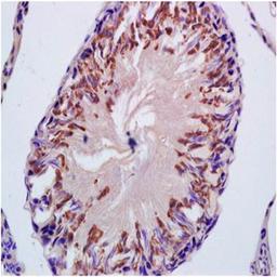 Paraffin-embedded rat testis tissue fixed with 4% paraformaldehyde. Antigen retrieval by boiling with citrate buffer. Blocking buffer is goat serum (37 degrees for 20 min.). CYP21 antibody at 1:200 dilution with overnight incubation at 4 degrees