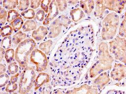 IHC image of CSB-PA017885LA01HU diluted at 1:300 and staining in paraffin-embedded human kidney tissue performed on a Leica BondTM system. After dewaxing and hydration, antigen retrieval was mediated by high pressure in a citrate buffer (pH 6.0). Section was blocked with 10% normal goat serum 30min at RT. Then primary antibody (1% BSA) was incubated at 4°C overnight. The primary is detected by a biotinylated secondary antibody and visualized using an HRP conjugated SP system.