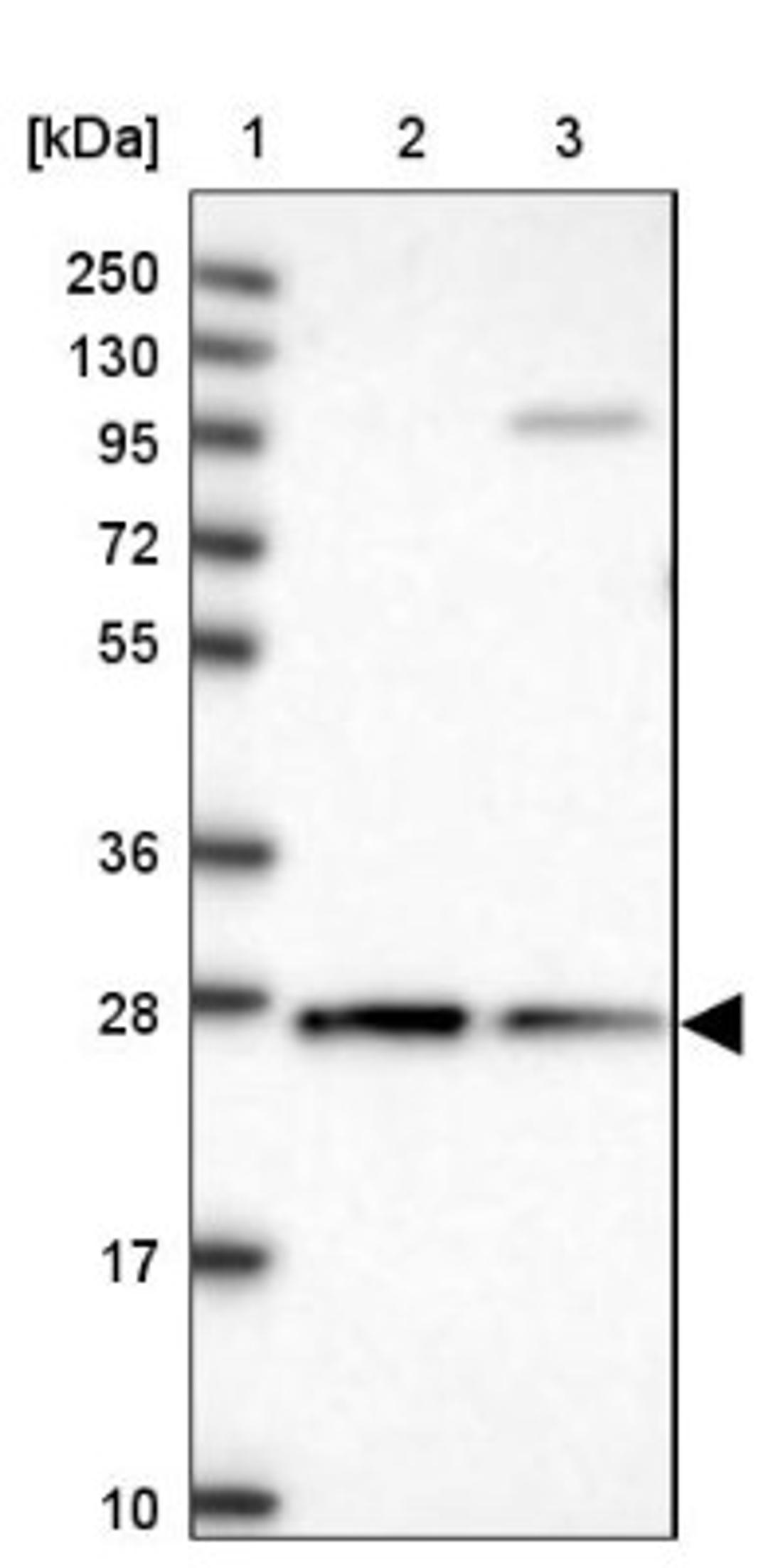 Western Blot: CYB5R2 Antibody [NBP1-85865] - Lane 1: Marker [kDa] 250, 130, 95, 72, 55, 36, 28, 17, 10<br/>Lane 2: Human cell line RT-4<br/>Lane 3: Human cell line U-251MG sp