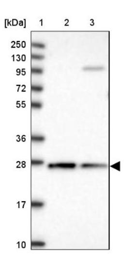 Western Blot: CYB5R2 Antibody [NBP1-85865] - Lane 1: Marker [kDa] 250, 130, 95, 72, 55, 36, 28, 17, 10<br/>Lane 2: Human cell line RT-4<br/>Lane 3: Human cell line U-251MG sp