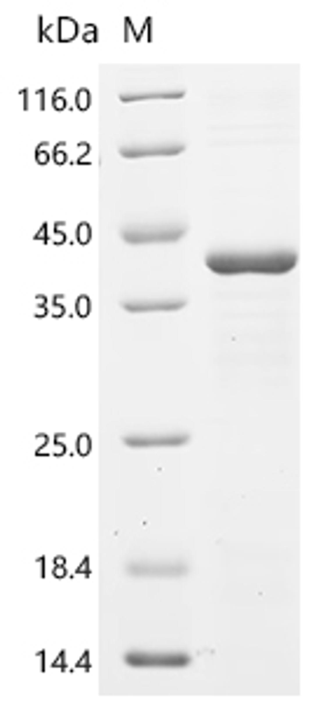 (Tris-Glycine gel) Discontinuous SDS-PAGE (reduced) with 5% enrichment gel and 15% separation gel.