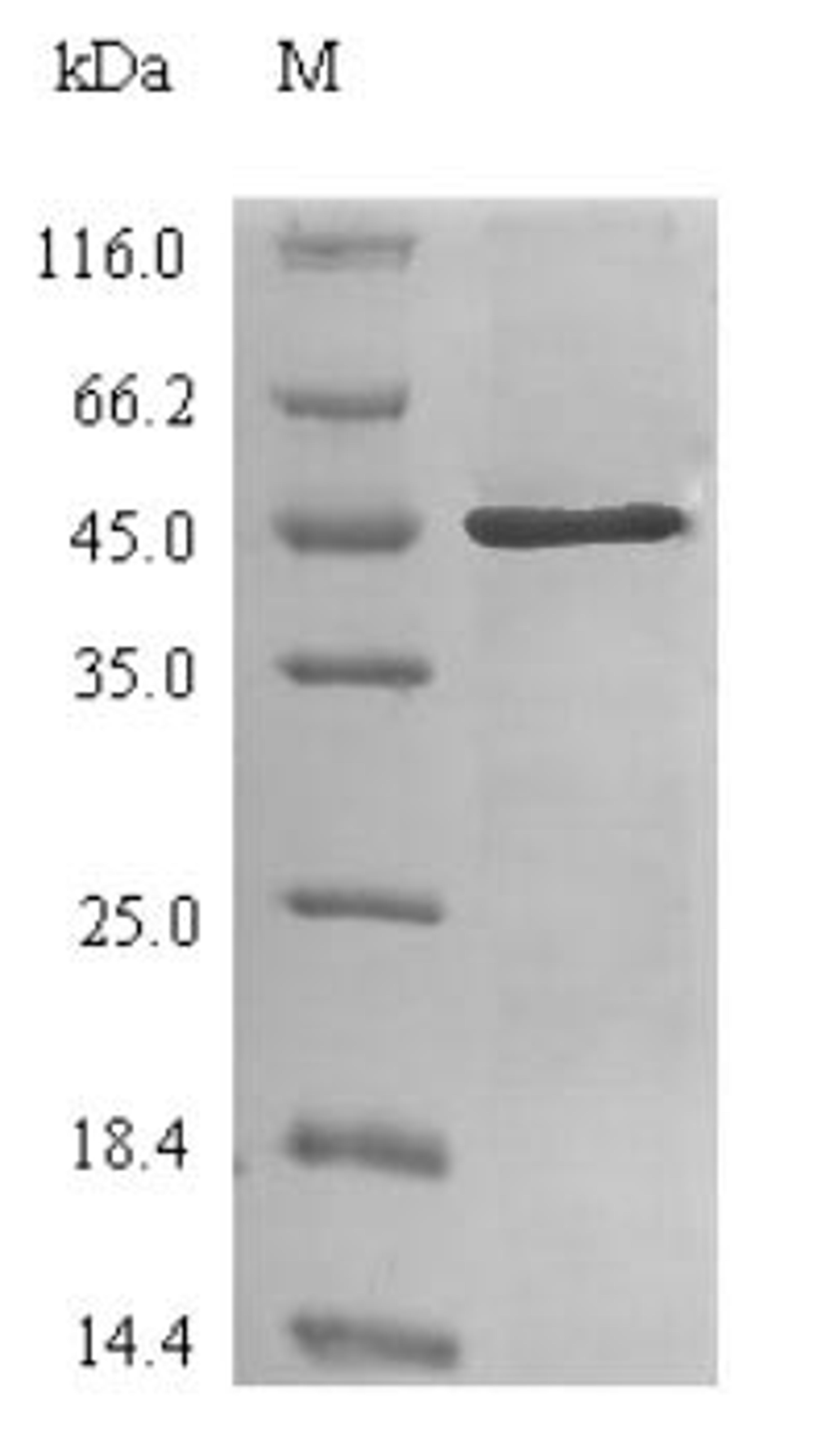 (Tris-Glycine gel) Discontinuous SDS-PAGE (reduced) with 5% enrichment gel and 15% separation gel.