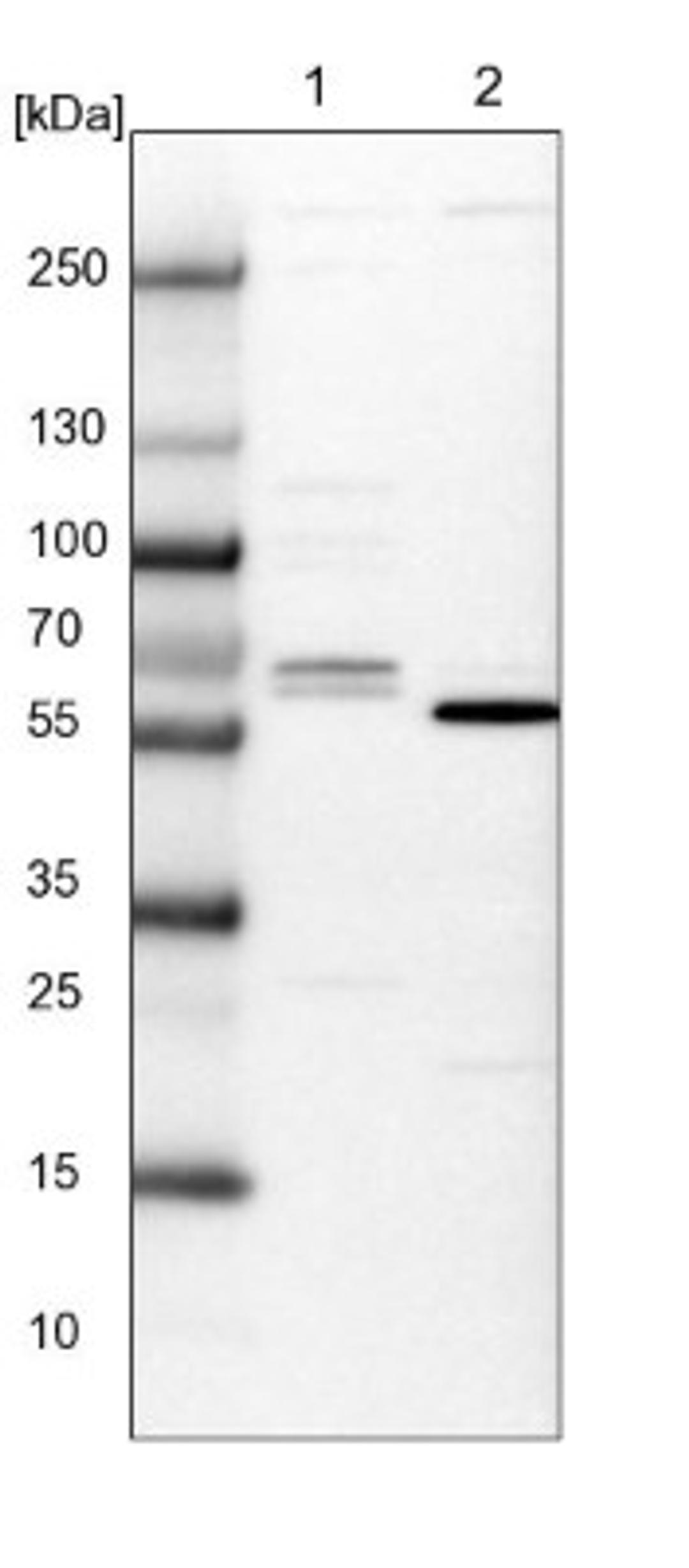 Western Blot: CTDSPL2 Antibody [NBP1-91814] - Lane 1: NIH-3T3 cell lysate (Mouse embryonic fibroblast cells)<br/>Lane 2: NBT-II cell lysate (Rat Wistar bladder tumour cells)