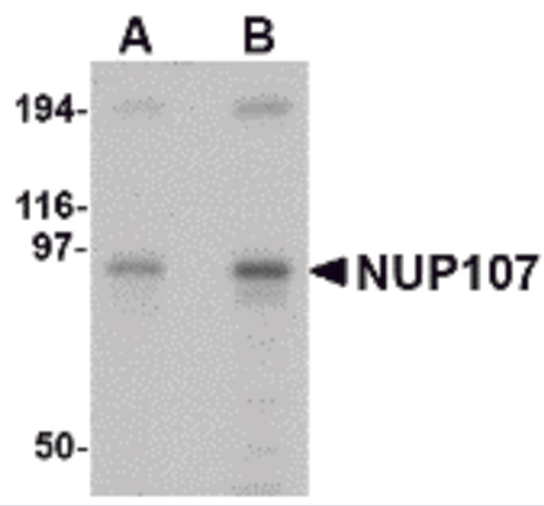 Western blot analysis of NUP107 in A549 cell lysate with NUP107 antibody at (A) 1 and (B) 2 &#956;g/mL.