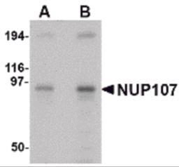 Western blot analysis of NUP107 in A549 cell lysate with NUP107 antibody at (A) 1 and (B) 2 &#956;g/mL.