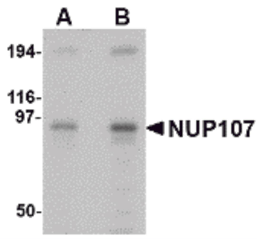 Western blot analysis of NUP107 in A549 cell lysate with NUP107 antibody at (A) 1 and (B) 2 μg/mL.