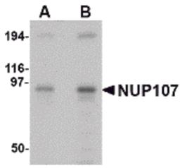 Western blot analysis of NUP107 in A549 cell lysate with NUP107 antibody at (A) 1 and (B) 2 μg/mL.
