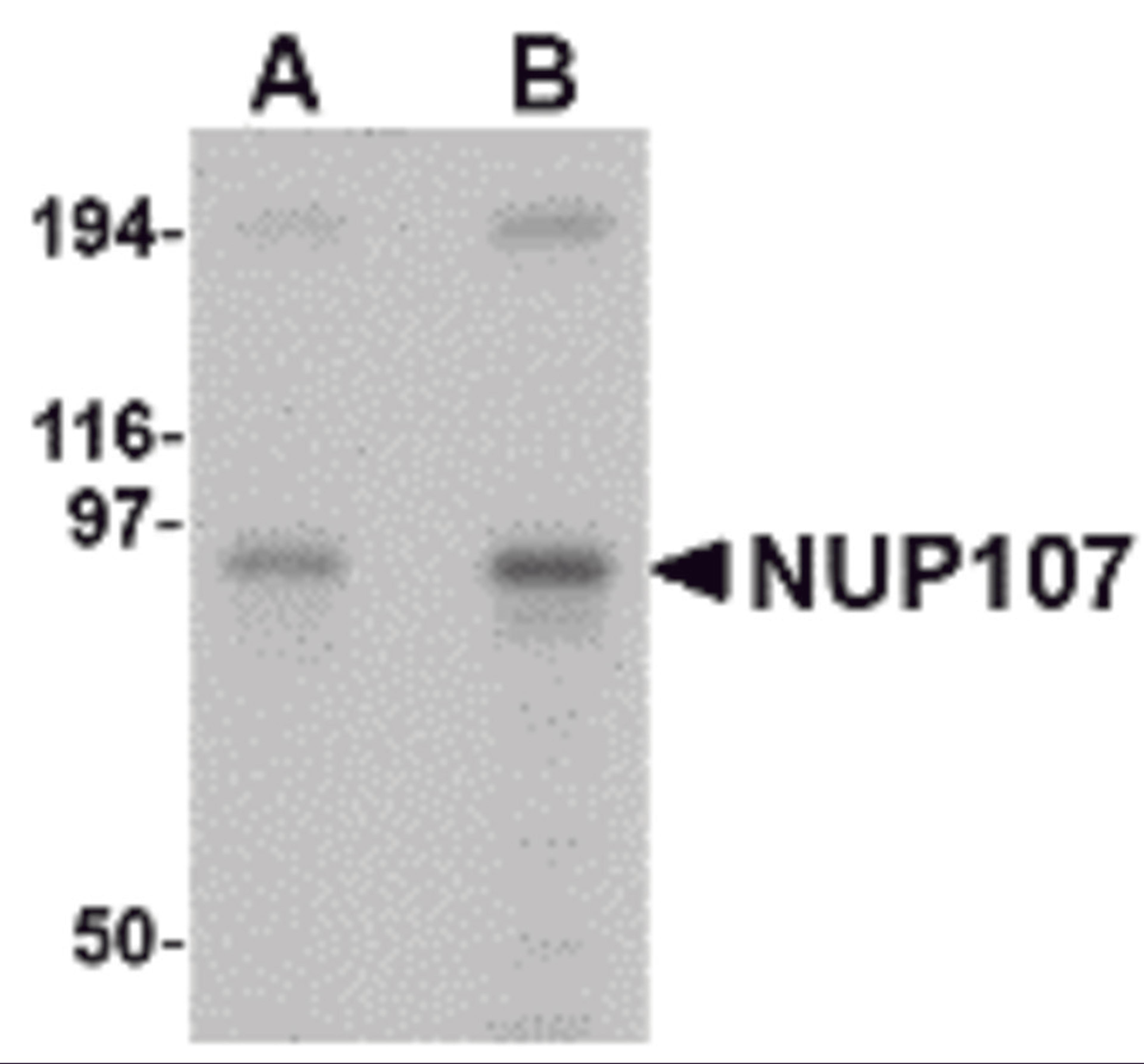 Western blot analysis of NUP107 in A549 cell lysate with NUP107 antibody at (A) 1 and (B) 2 μg/mL.