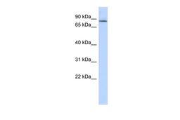 Antibody used in WB on Human Lung at 0.2-1 ug/ml.