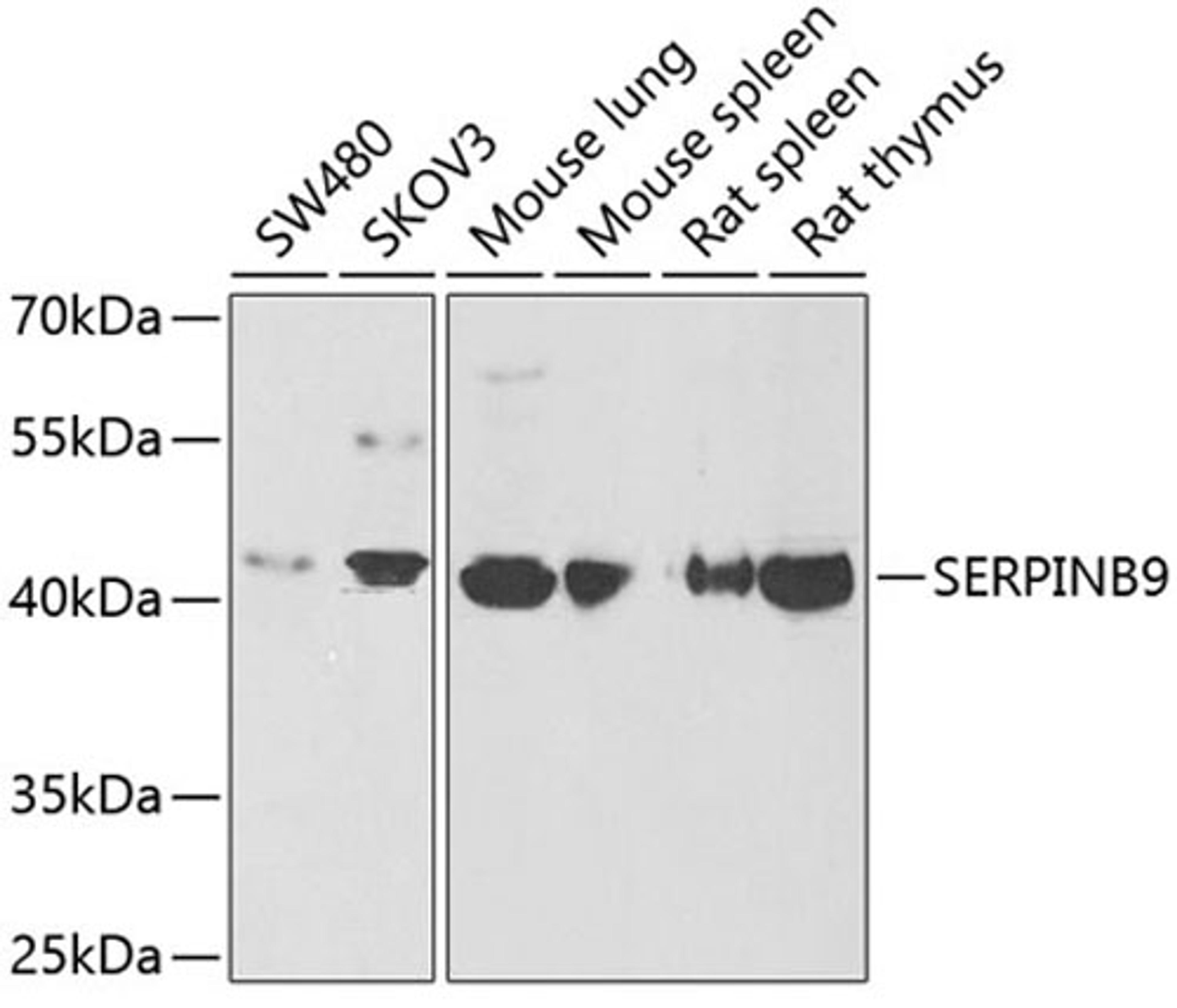 Western blot - SERPINB9 antibody (A6393)