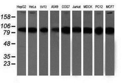 Western Blot: Proteasome 19S 10B Antibody (1G6) [NBP2-00990] Analysis of extracts (35ug) from 9 different cell lines by using anti-Proteasome 19S 10B monoclonal antibody.