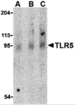 Western blot analysis of TLR5 in rat brain cell lysate with TLR5 antibody at (A) 0.5, (B) 1 and (C) 2 &#956;g/mL.