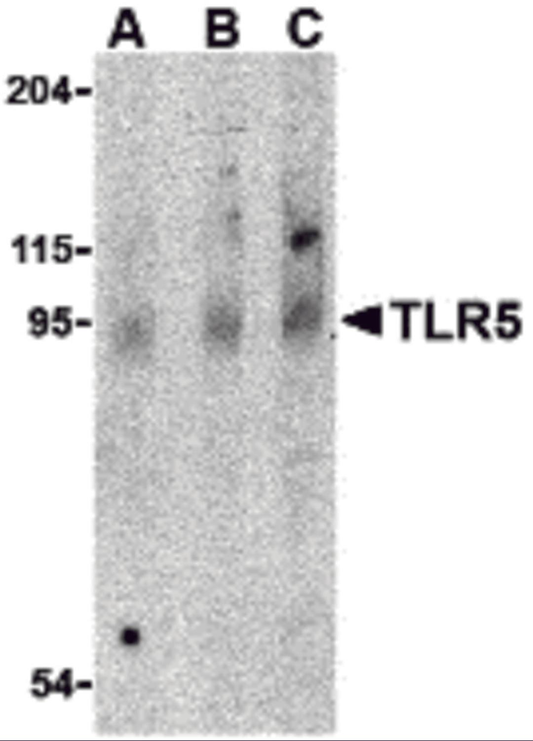 Western blot analysis of TLR5 in rat brain cell lysate with TLR5 antibody at (A) 0.5, (B) 1 and (C) 2 μg/mL.
