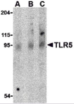 Western blot analysis of TLR5 in rat brain cell lysate with TLR5 antibody at (A) 0.5, (B) 1 and (C) 2 μg/mL.